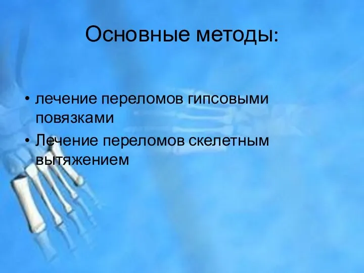 Основные методы: лечение переломов гипсовыми повязками Лечение переломов скелетным вытяжением