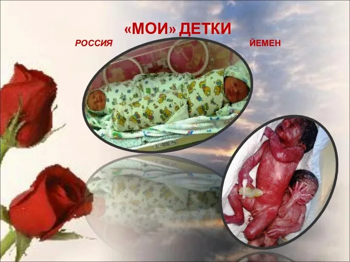 «МОИ» ДЕТКИ РОССИЯ ЙЕМЕН