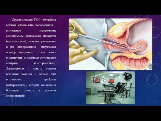 Другие методы: УЗИ - эхография органов малого таза. Кольпоскопия - визуальное