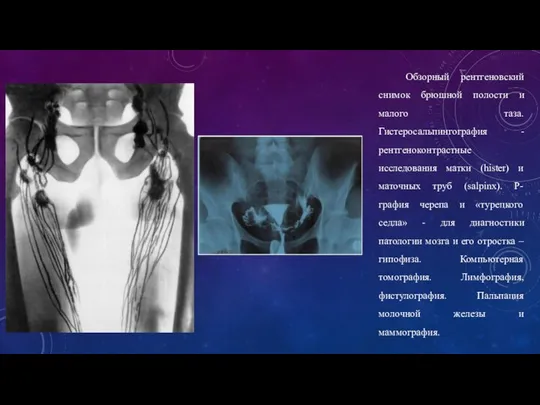Обзорный рентгеновский снимок брюшной полости и малого таза. Гистеросальпингография - рентгеноконтрастные