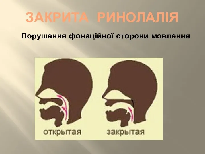 ЗАКРИТА РИНОЛАЛІЯ Порушення фонаційної сторони мовлення