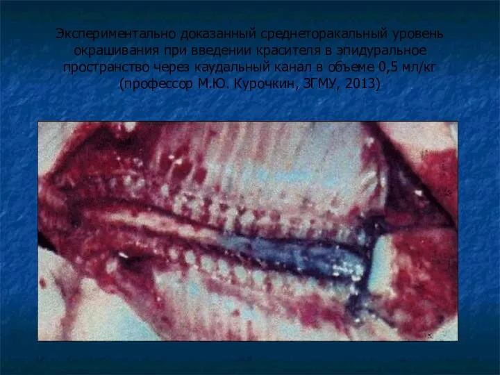 Экспериментально доказанный среднеторакальный уровень окрашивания при введении красителя в эпидуральное пространство