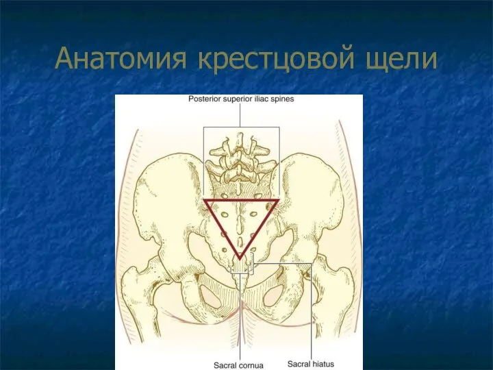 Анатомия крестцовой щели