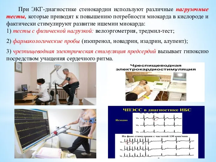 При ЭКГ-диагностике стенокардии используют различные нагрузочные тесты, которые приводят к повышению