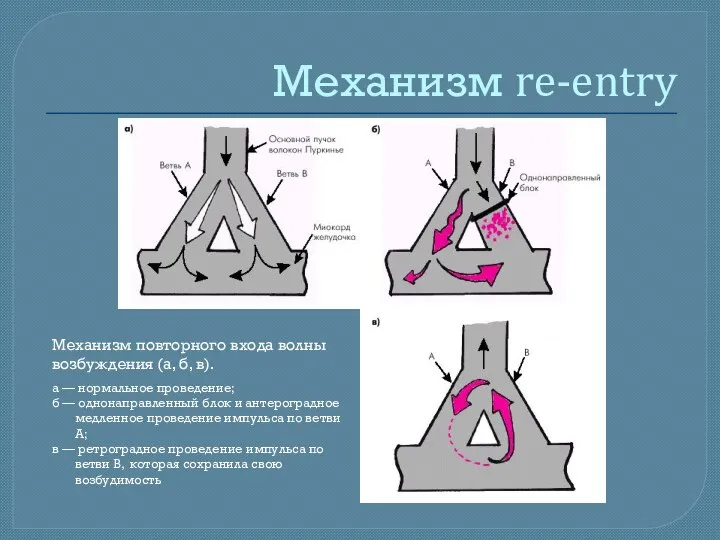 Механизм re-entry Механизм повторного входа волны возбуждения (а, б, в). а