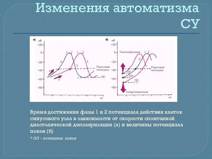 Изменения автоматизма СУ Время достижения фазы 1 и 2 потенциала действия