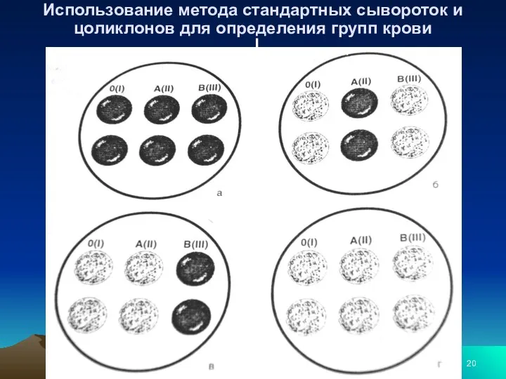 Использование метода стандартных сывороток и цоликлонов для определения групп крови