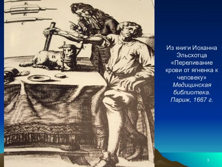 Из книги Иоханна Эльсхотца «Переливание крови от ягненка к человеку» Медицинская библиотека. Париж, 1667 г.
