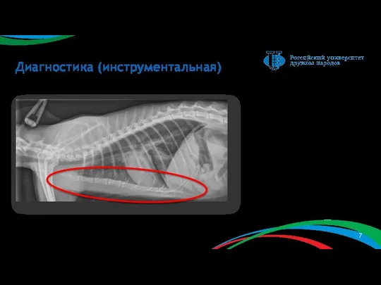 Диагностика (инструментальная) Рис. 3 – рентгеновский снимок в правой латеральной проекции (нормальное развитие грудины)