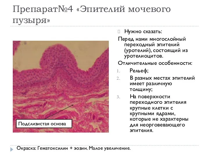 Препарат№4 «Эпителий мочевого пузыря» Нужно сказать: Перед нами многослойный переходный эпителий