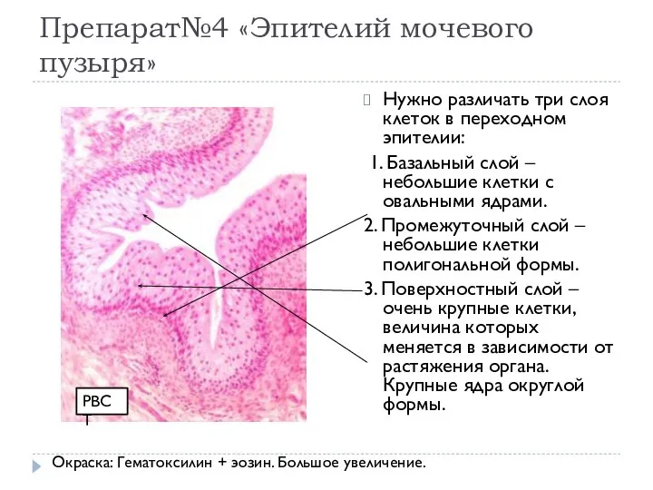 Препарат№4 «Эпителий мочевого пузыря» Нужно различать три слоя клеток в переходном