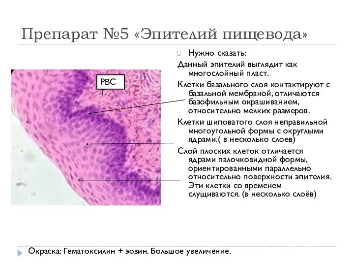 Препарат №5 «Эпителий пищевода» Нужно сказать: Данный эпителий выглядит как многослойный