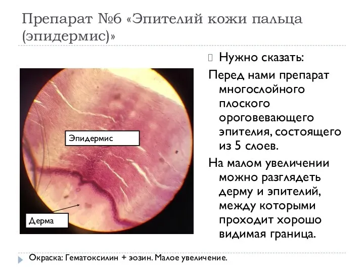 Препарат №6 «Эпителий кожи пальца (эпидермис)» Нужно сказать: Перед нами препарат