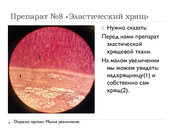 Препарат №8 «Эластический хрящ» Нужно сказать: Перед нами препарат эластической хрящевой