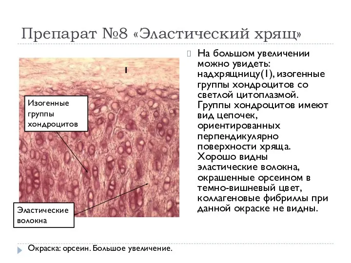 Препарат №8 «Эластический хрящ» На большом увеличении можно увидеть: надхрящницу(1), изогенные