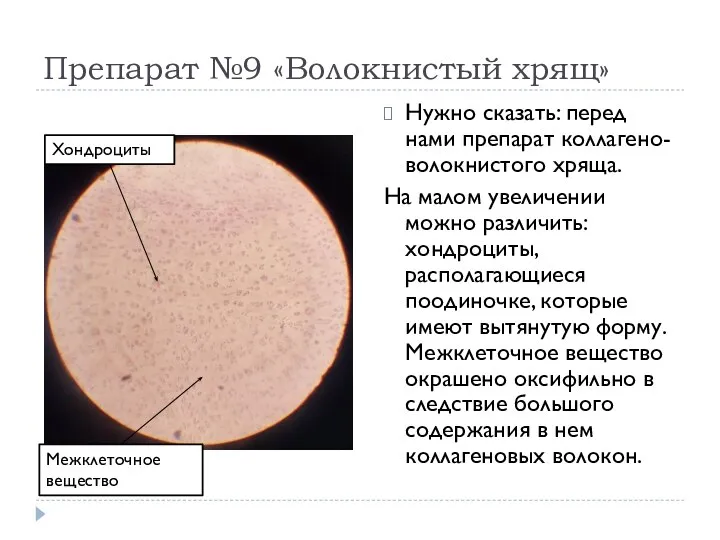 Препарат №9 «Волокнистый хрящ» Нужно сказать: перед нами препарат коллагено-волокнистого хряща.