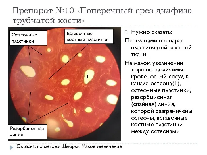 Препарат №10 «Поперечный срез диафиза трубчатой кости» Нужно сказать: Перед нами