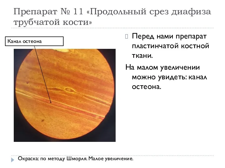 Препарат № 11 «Продольный срез диафиза трубчатой кости» Перед нами препарат