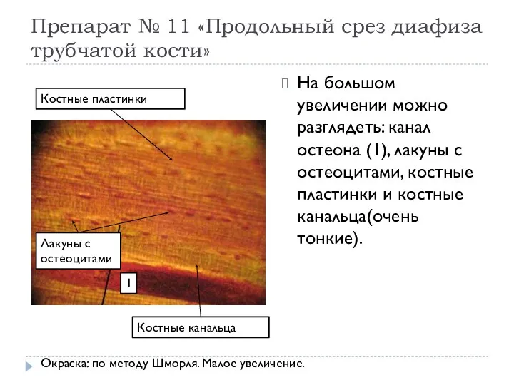 Препарат № 11 «Продольный срез диафиза трубчатой кости» На большом увеличении