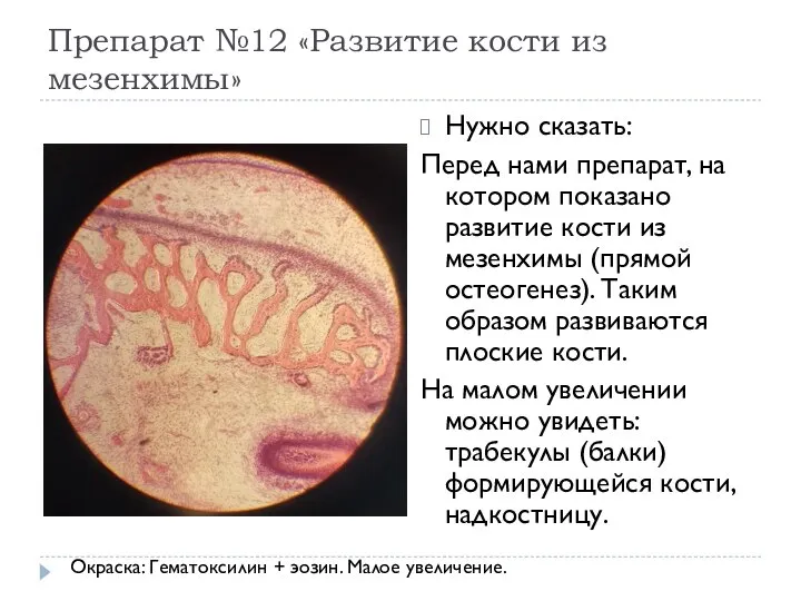 Препарат №12 «Развитие кости из мезенхимы» Нужно сказать: Перед нами препарат,