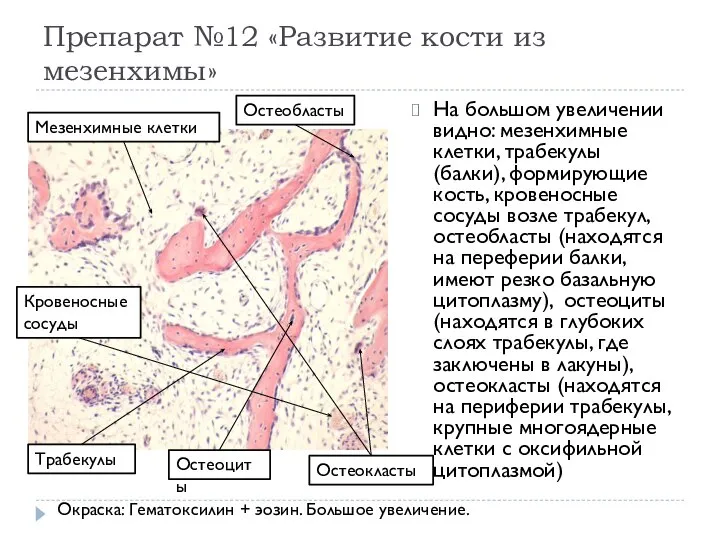 Препарат №12 «Развитие кости из мезенхимы» На большом увеличении видно: мезенхимные