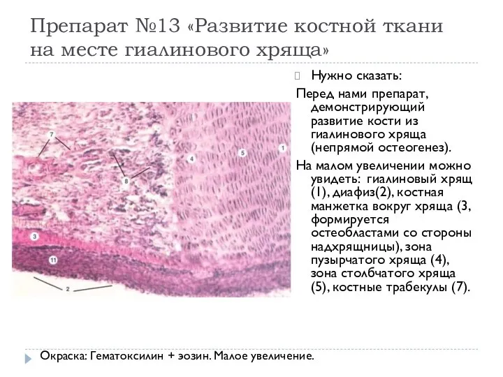 Препарат №13 «Развитие костной ткани на месте гиалинового хряща» Нужно сказать: