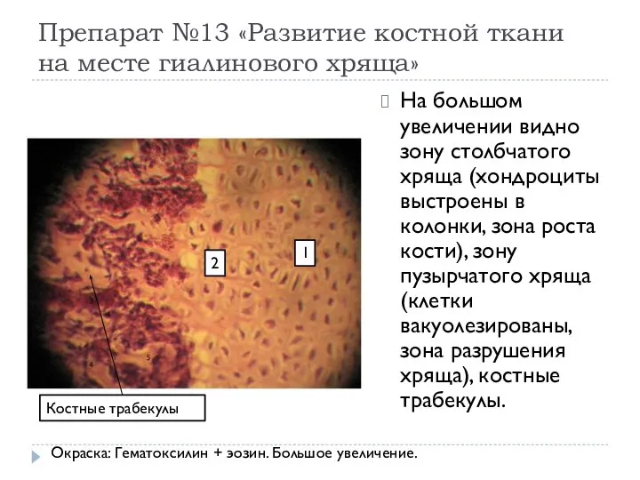 Препарат №13 «Развитие костной ткани на месте гиалинового хряща» На большом