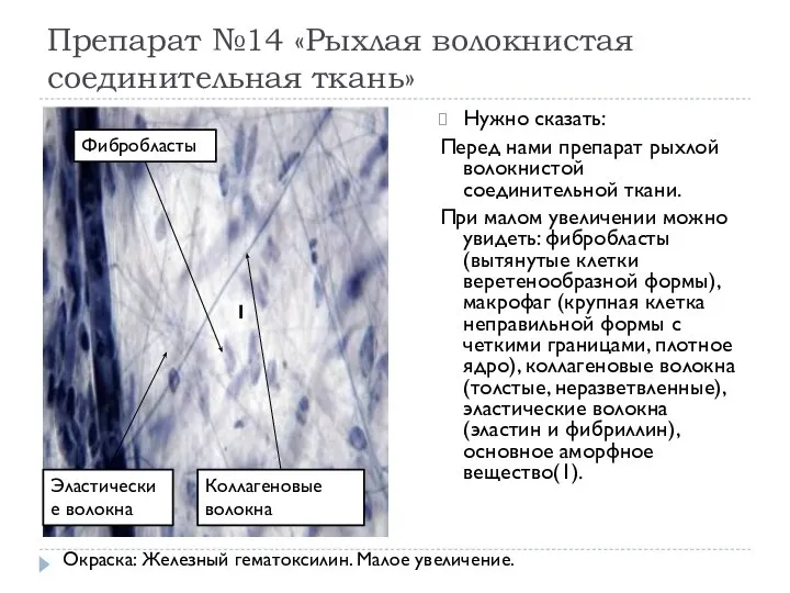 Препарат №14 «Рыхлая волокнистая соединительная ткань» Нужно сказать: Перед нами препарат