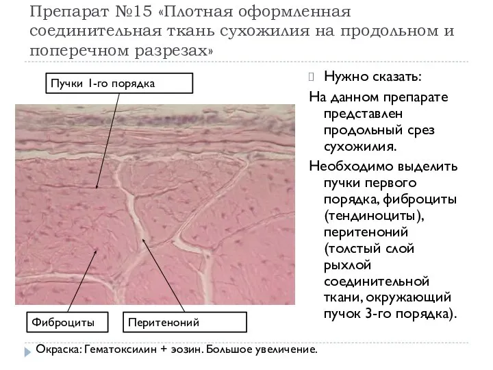Препарат №15 «Плотная оформленная соединительная ткань сухожилия на продольном и поперечном