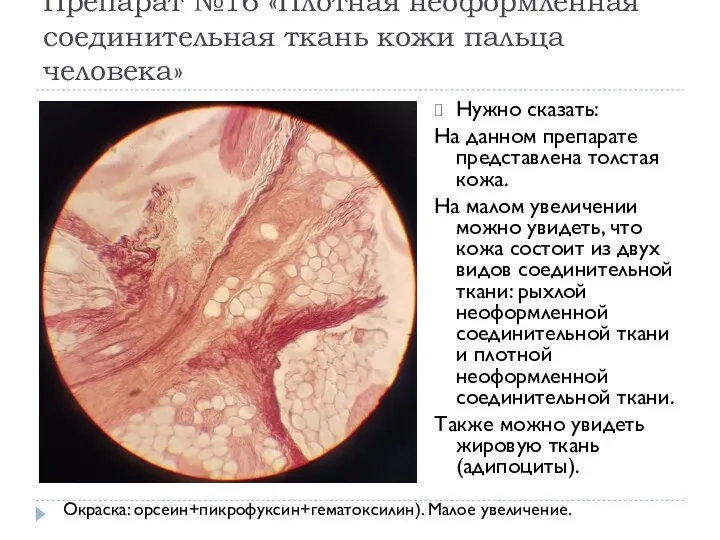 Препарат №16 «Плотная неоформленная соединительная ткань кожи пальца человека» Нужно сказать: