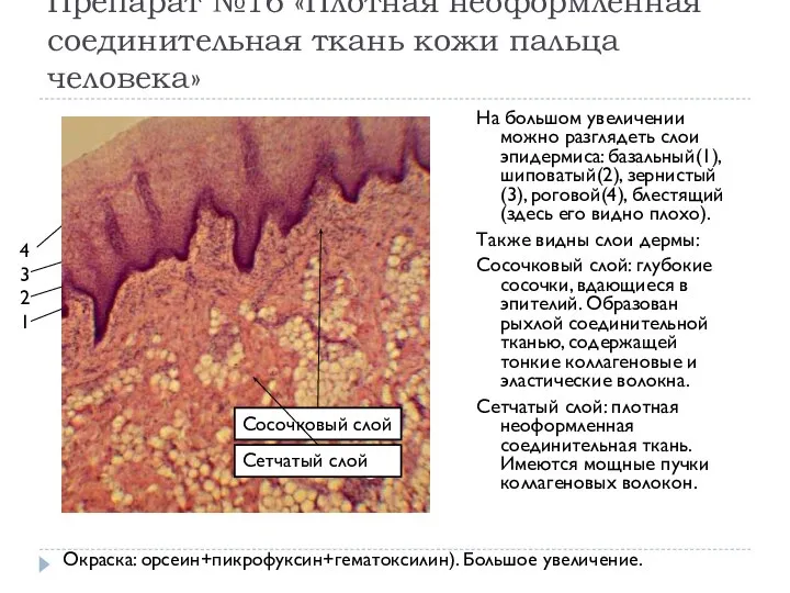 Препарат №16 «Плотная неоформленная соединительная ткань кожи пальца человека» На большом