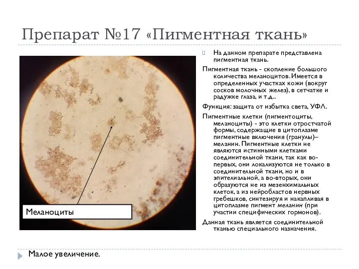 Препарат №17 «Пигментная ткань» На данном препарате представлена пигментная ткань. Пигментная