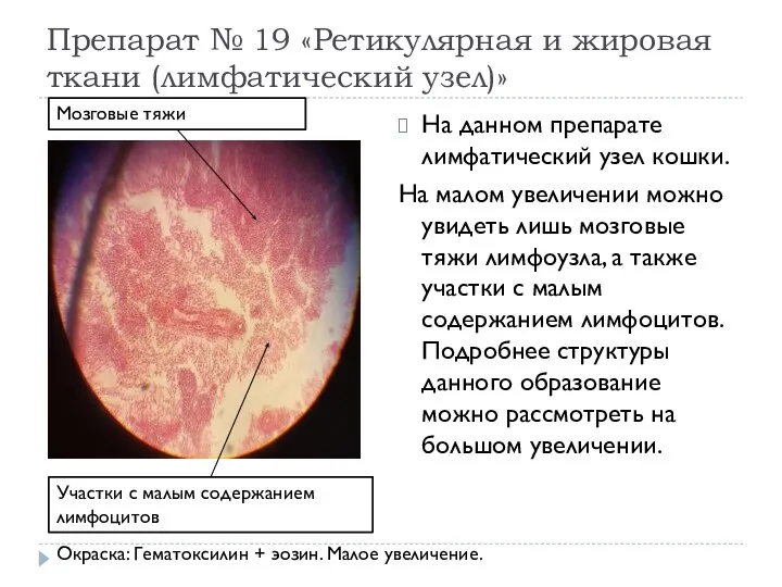 Препарат № 19 «Ретикулярная и жировая ткани (лимфатический узел)» На данном