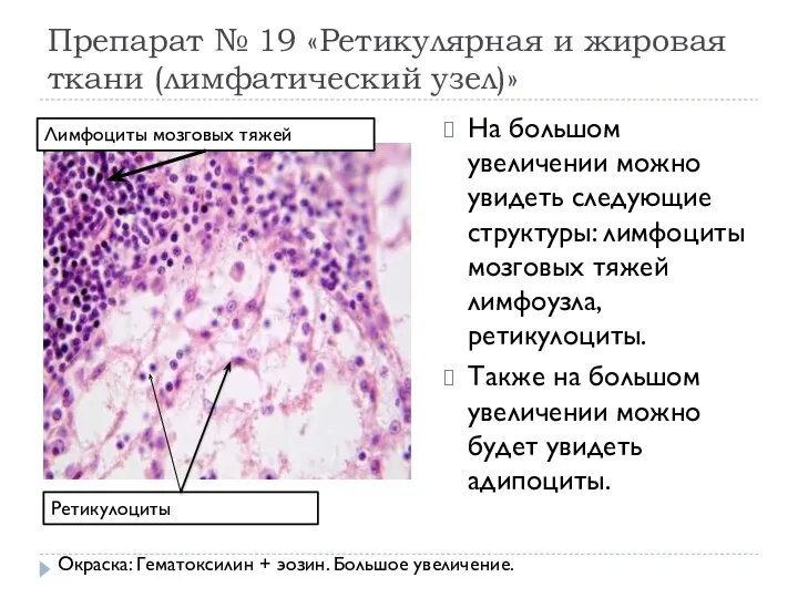 Препарат № 19 «Ретикулярная и жировая ткани (лимфатический узел)» На большом