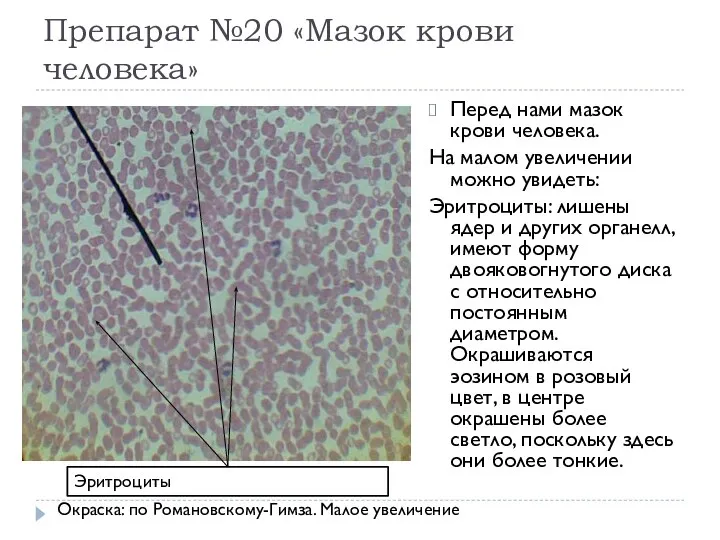 Препарат №20 «Мазок крови человека» Перед нами мазок крови человека. На
