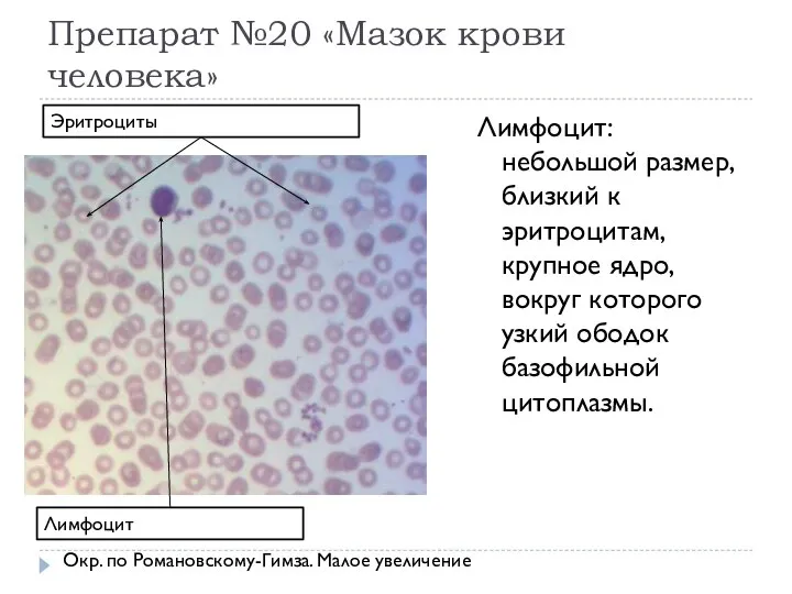 Препарат №20 «Мазок крови человека» Лимфоцит: небольшой размер, близкий к эритроцитам,