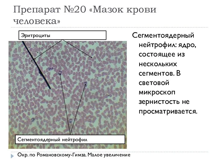 Препарат №20 «Мазок крови человека» Сегментоядерный нейтрофил: ядро, состоящее из нескольких