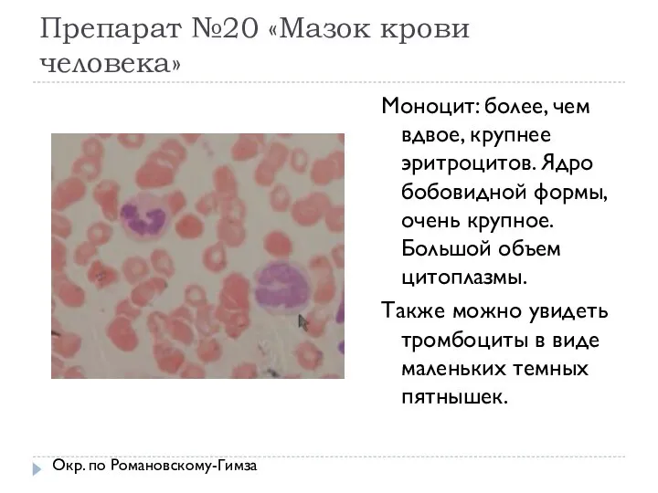 Препарат №20 «Мазок крови человека» Моноцит: более, чем вдвое, крупнее эритроцитов.