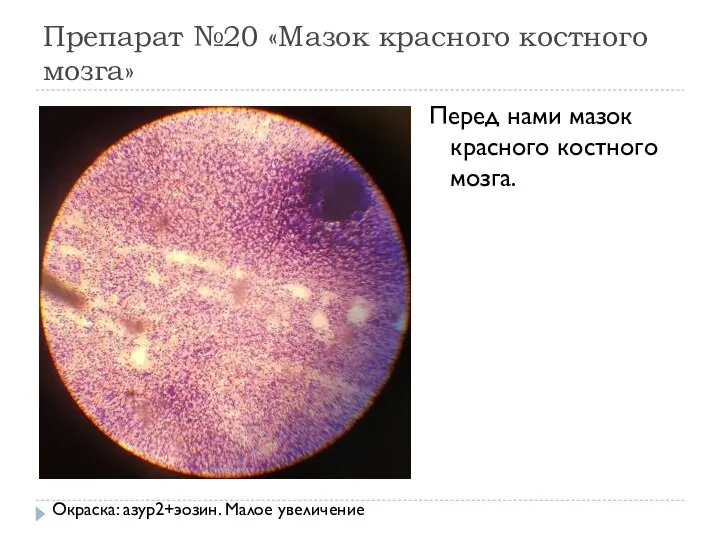 Препарат №20 «Мазок красного костного мозга» Перед нами мазок красного костного мозга. Окраска: азур2+эозин. Малое увеличение