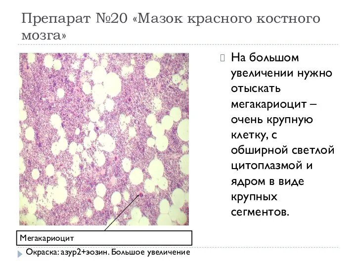 Препарат №20 «Мазок красного костного мозга» На большом увеличении нужно отыскать