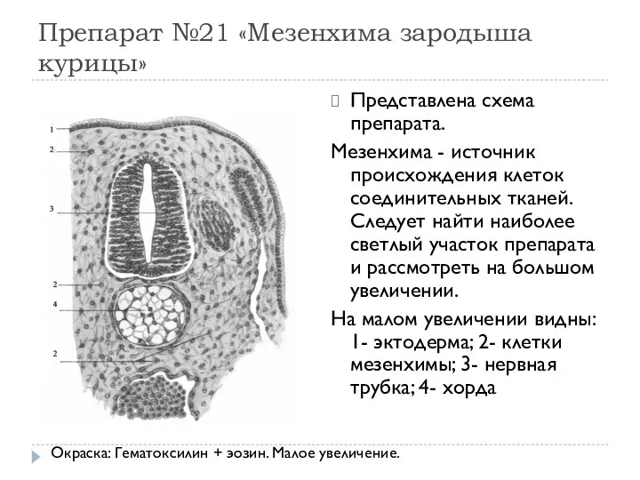 Препарат №21 «Мезенхима зародыша курицы» Представлена схема препарата. Мезенхима - источник