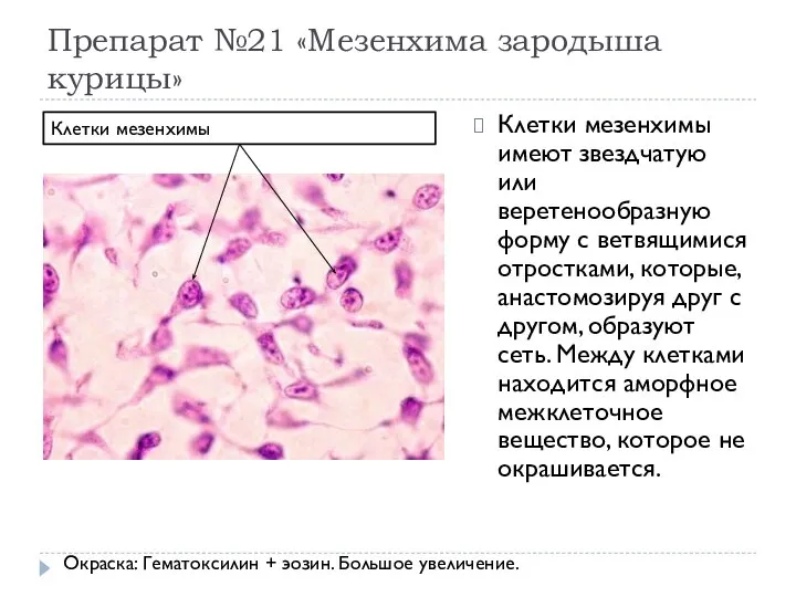 Препарат №21 «Мезенхима зародыша курицы» Клетки мезенхимы имеют звездчатую или веретенообразную