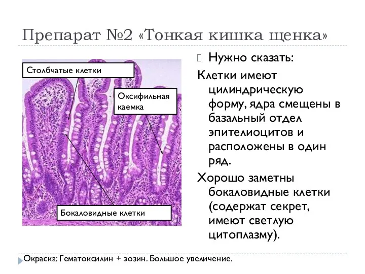 Препарат №2 «Тонкая кишка щенка» Нужно сказать: Клетки имеют цилиндрическую форму,