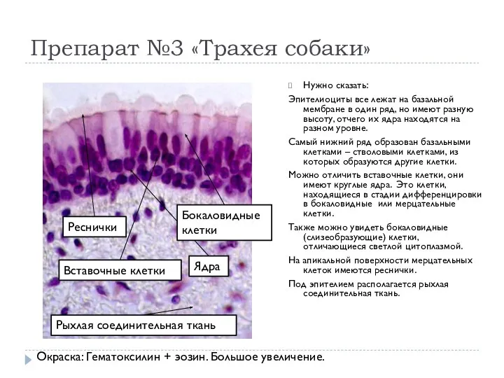 Препарат №3 «Трахея собаки» Нужно сказать: Эпителиоциты все лежат на базальной