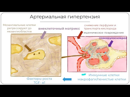 снижение перфузии и транспорта кислорода ишемическое повреждение Иммунные клетки макрофаги/пенистые клетки