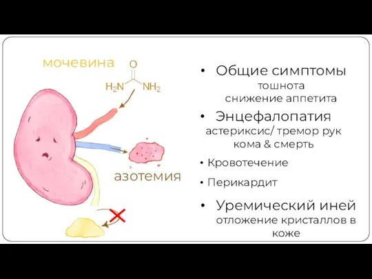 мочевина азотемия Энцефалопатия астериксис/ тремор рук кома & смерть Перикардит Кровотечение