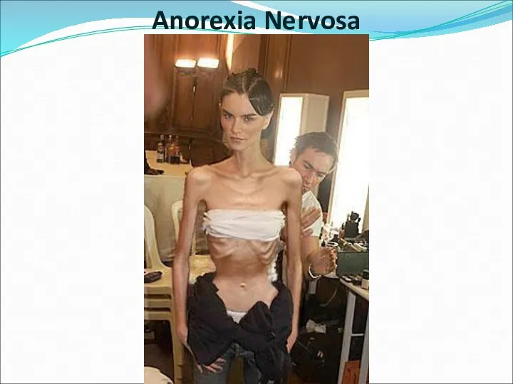 Anorexia Nervosa