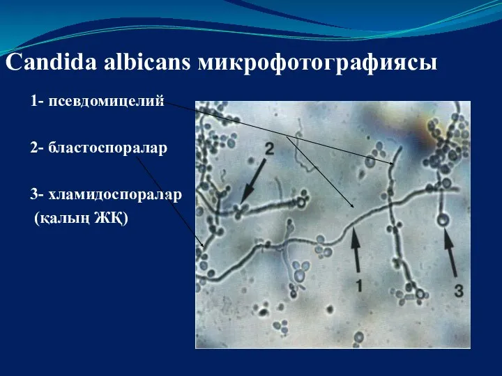 Candida albicans микрофотографиясы 1- псевдомицелий 2- бластоспоралар 3- хламидоспоралар (қалың ЖҚ)