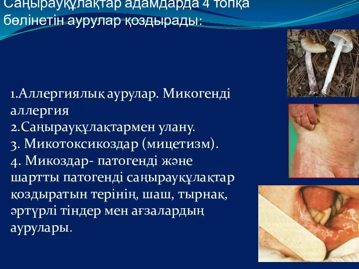 Саңырауқұлақтар адамдарда 4 топқа бөлінетін аурулар қоздырады: 1.Аллергиялық аурулар. Микогенді аллергия