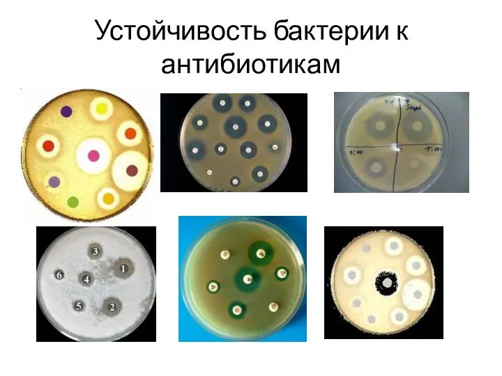 Устойчивость бактерии к антибиотикам